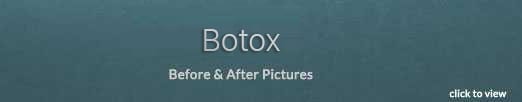 Botox® in Virginia Beach, VA